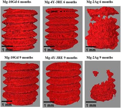 Assessing the long-term in vivo degradation behavior of magnesium alloys - a high resolution synchrotron radiation micro computed tomography study